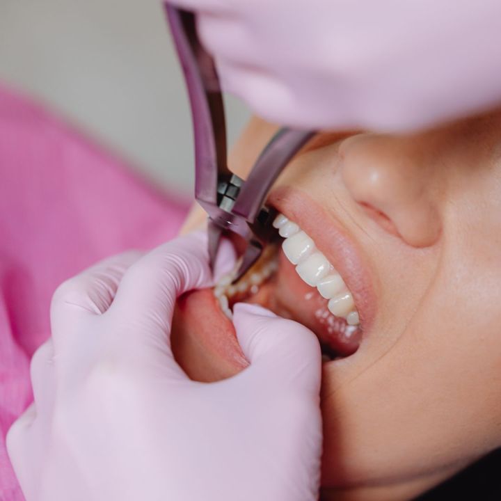 Endodonție