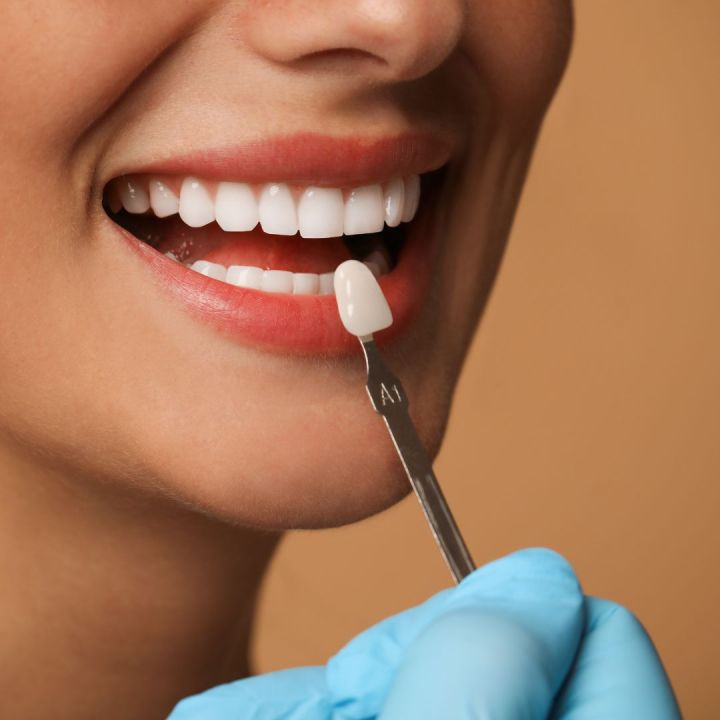 Estetică dentară